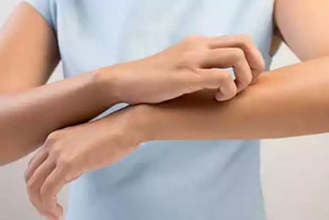 کلستاز در بارداری چیست و چه علائمی دارد؟